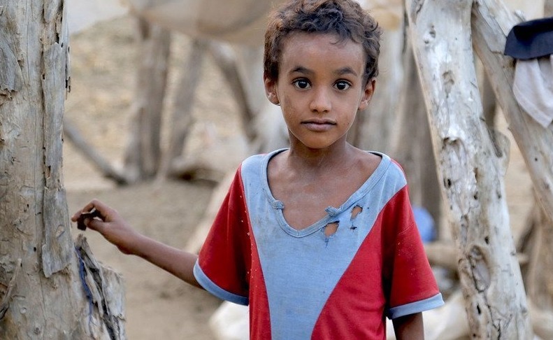 child in Yemn © UNICEF/UN0276430/Almahbashi